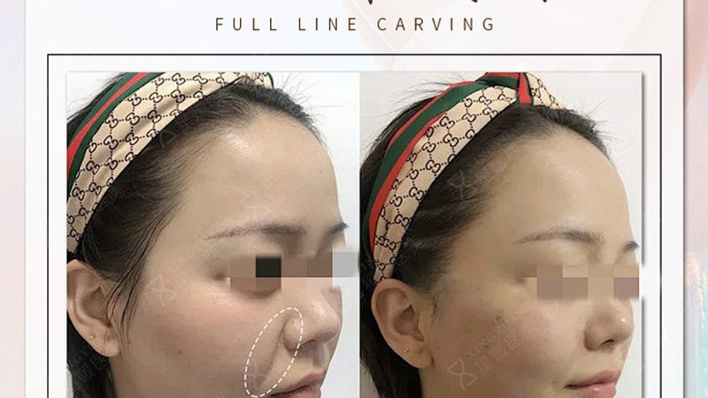 成都皮肤管理加盟费用明细，你了解多少？**