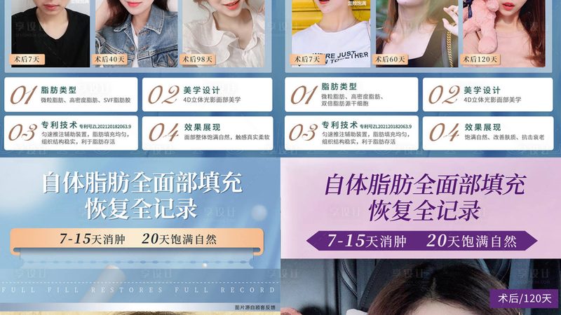 热玛吉术前，这些注意事项你了解吗？**