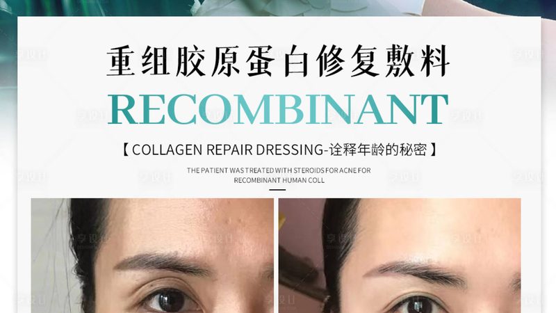 美容院光子嫩肤仪报价相差十倍，钱到底差在哪