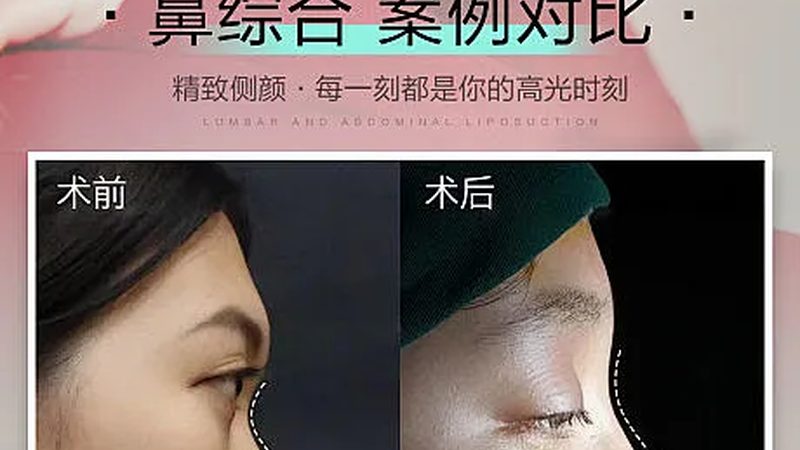 医美咨询师：职业选择背后的真实考量