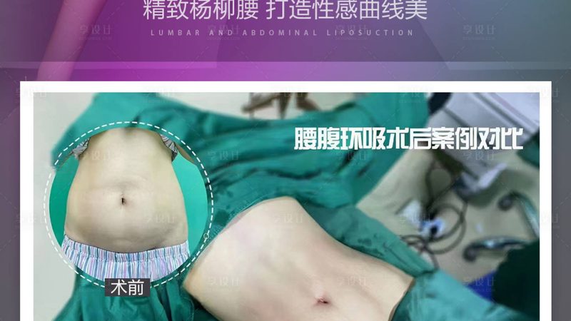 超声炮安装调试，揭秘价格背后的秘密