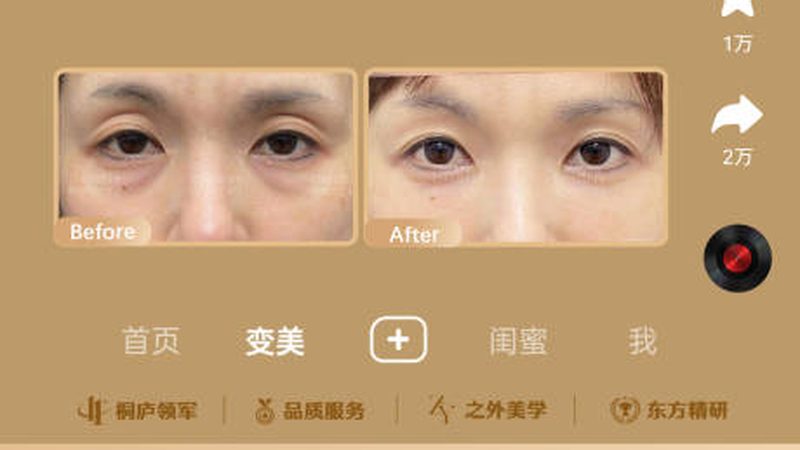 北京下颌角截骨失败修复，揭秘价格背后的真相