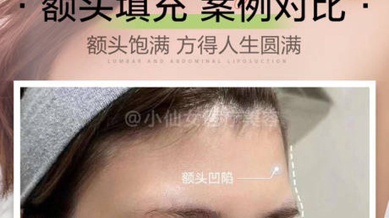 激光祛斑后涂什么药膏好